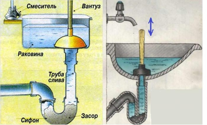 вантуз